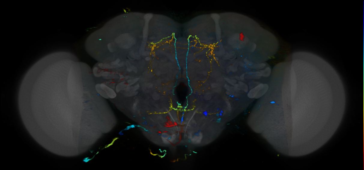 P{VT039434-GAL4} expression pattern