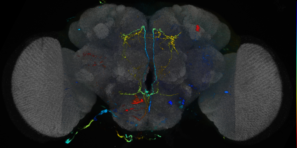 P{VT039434-GAL4} expression pattern