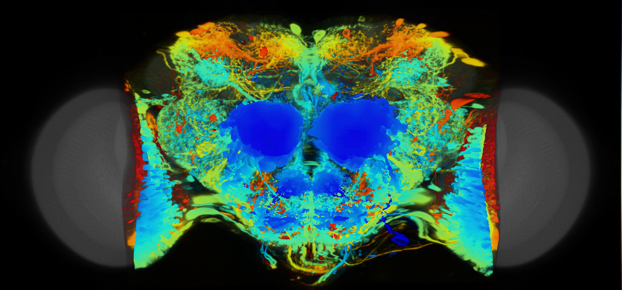 P{VT039457-GAL4} expression pattern