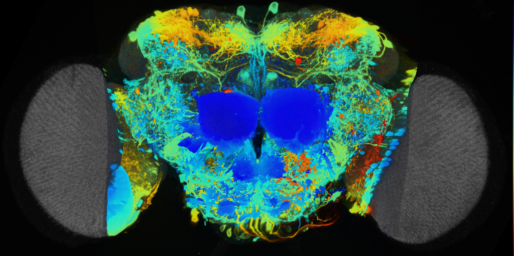 P{VT039457-GAL4} expression pattern