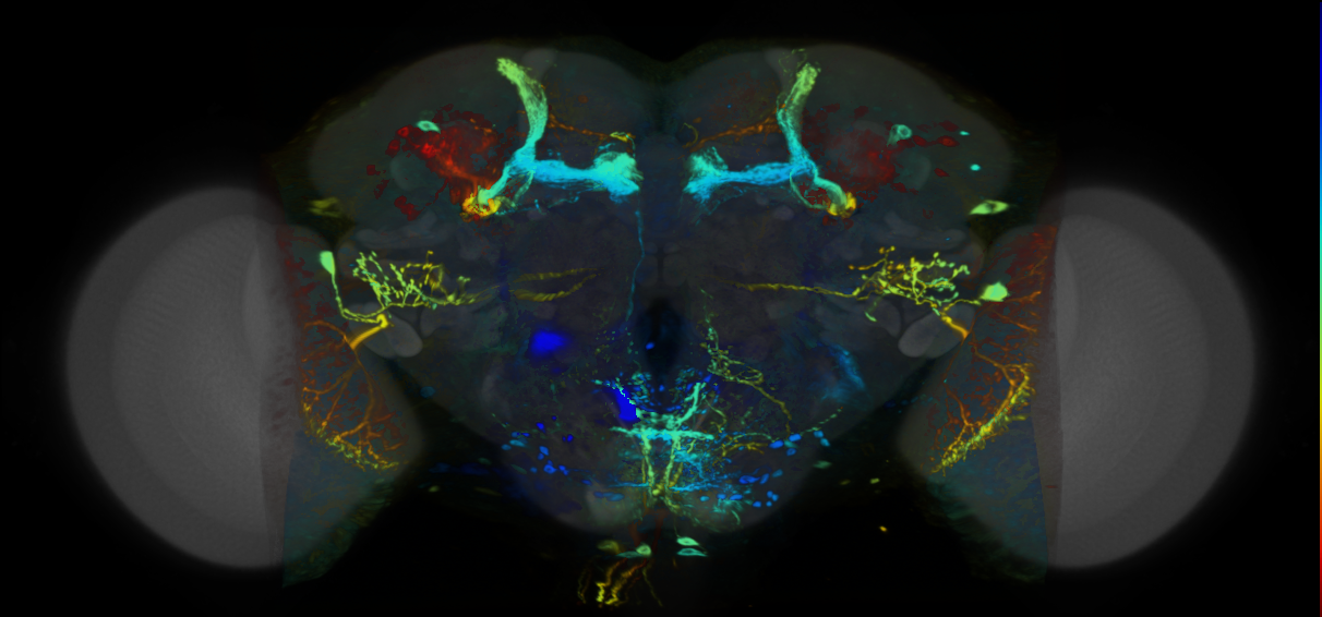 P{VT040034-GAL4} expression pattern