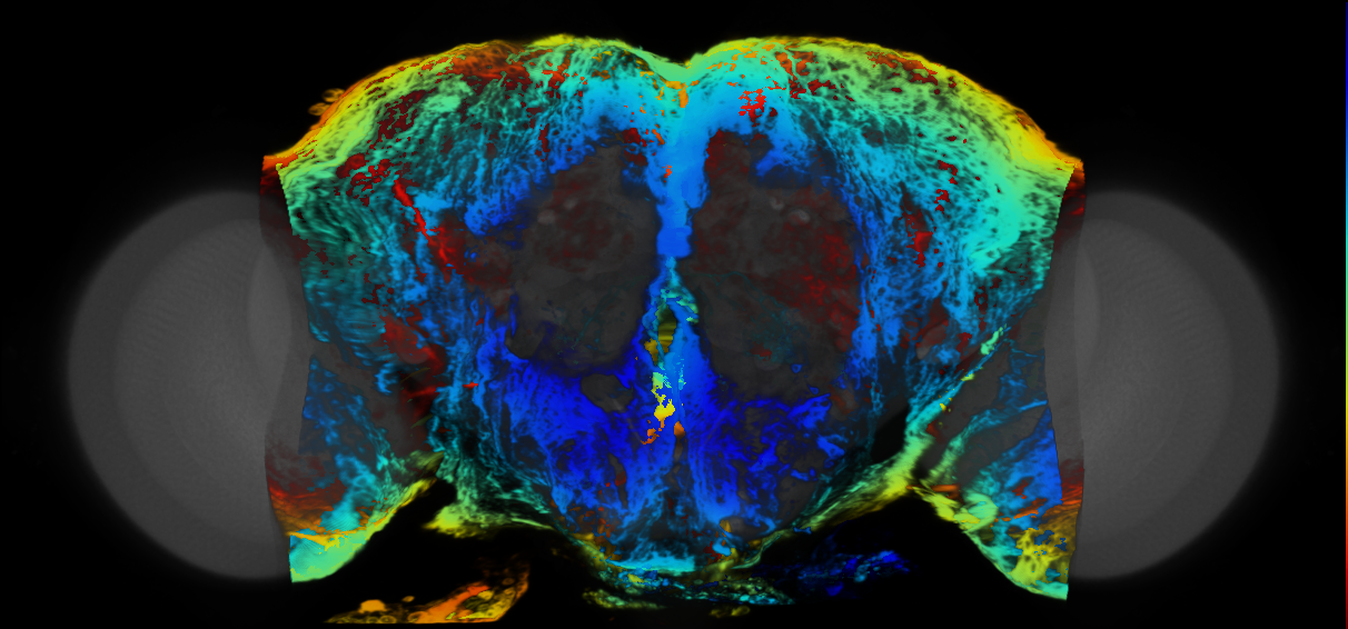 P{VT041371-GAL4} expression pattern