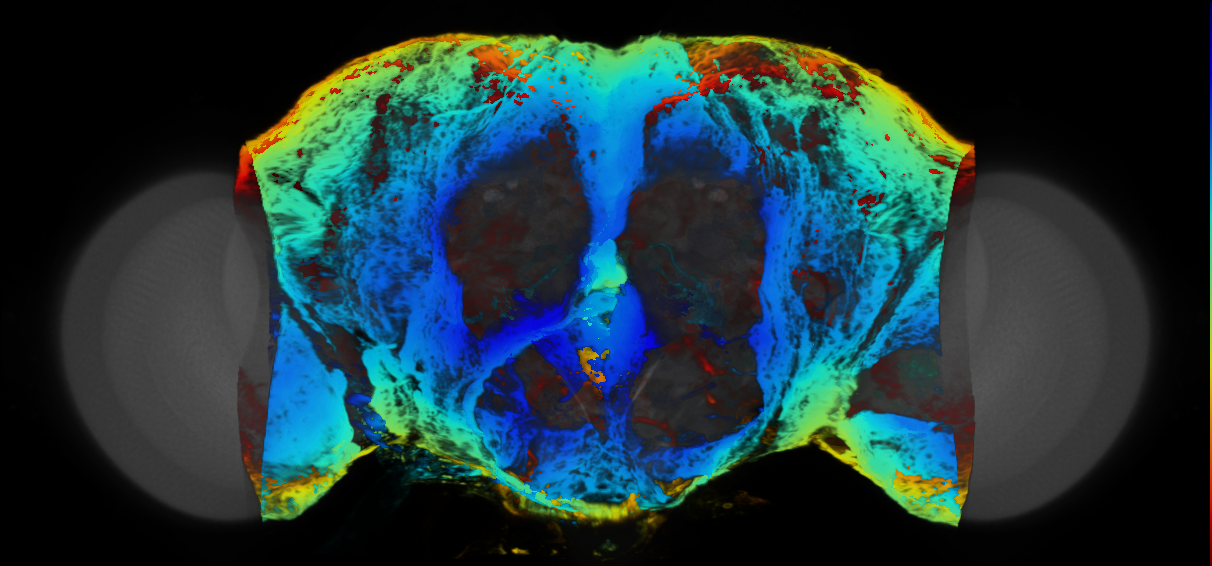 P{VT041371-GAL4} expression pattern
