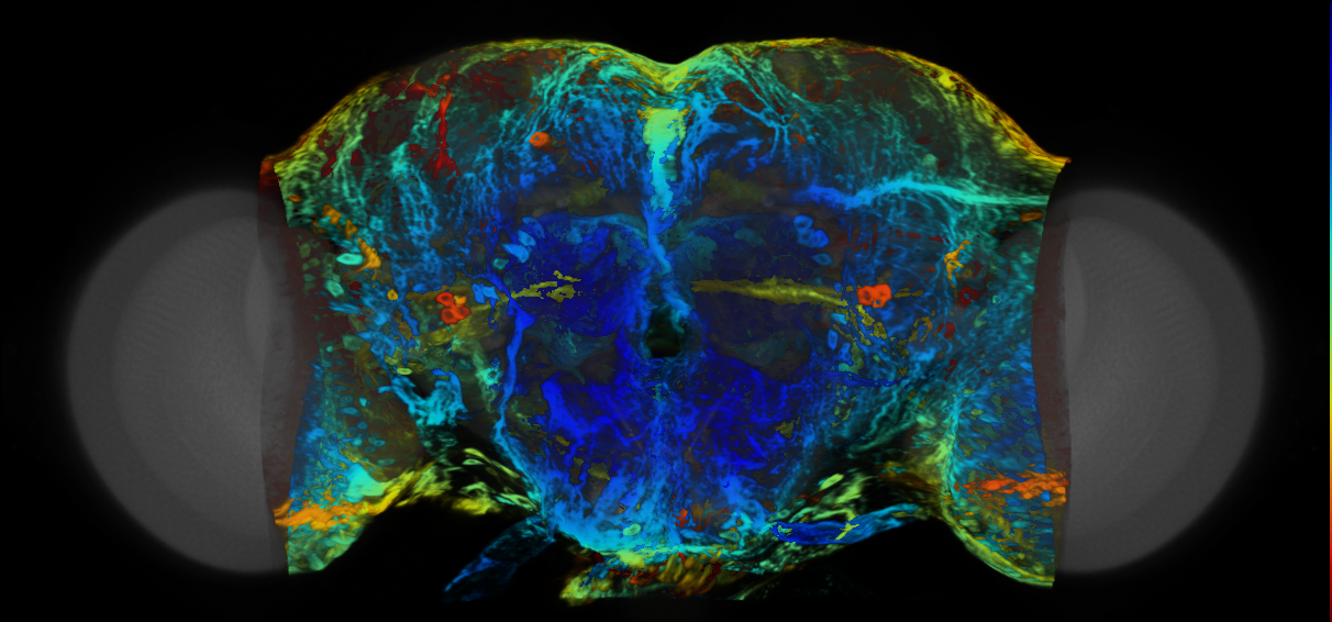 P{VT041381-GAL4} expression pattern