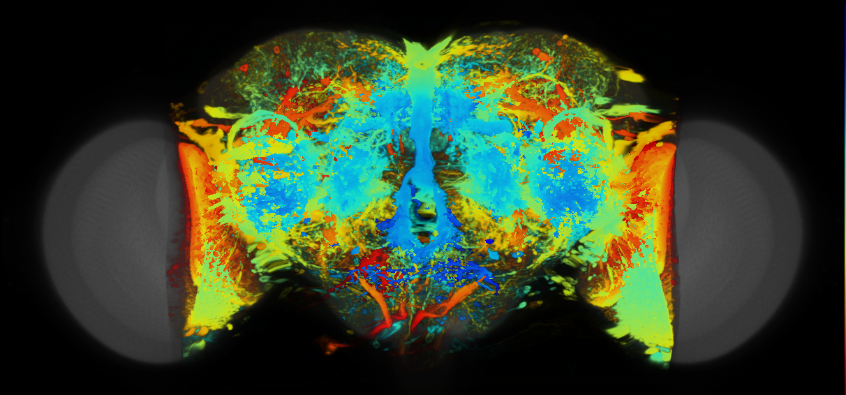 P{VT043066-GAL4} expression pattern