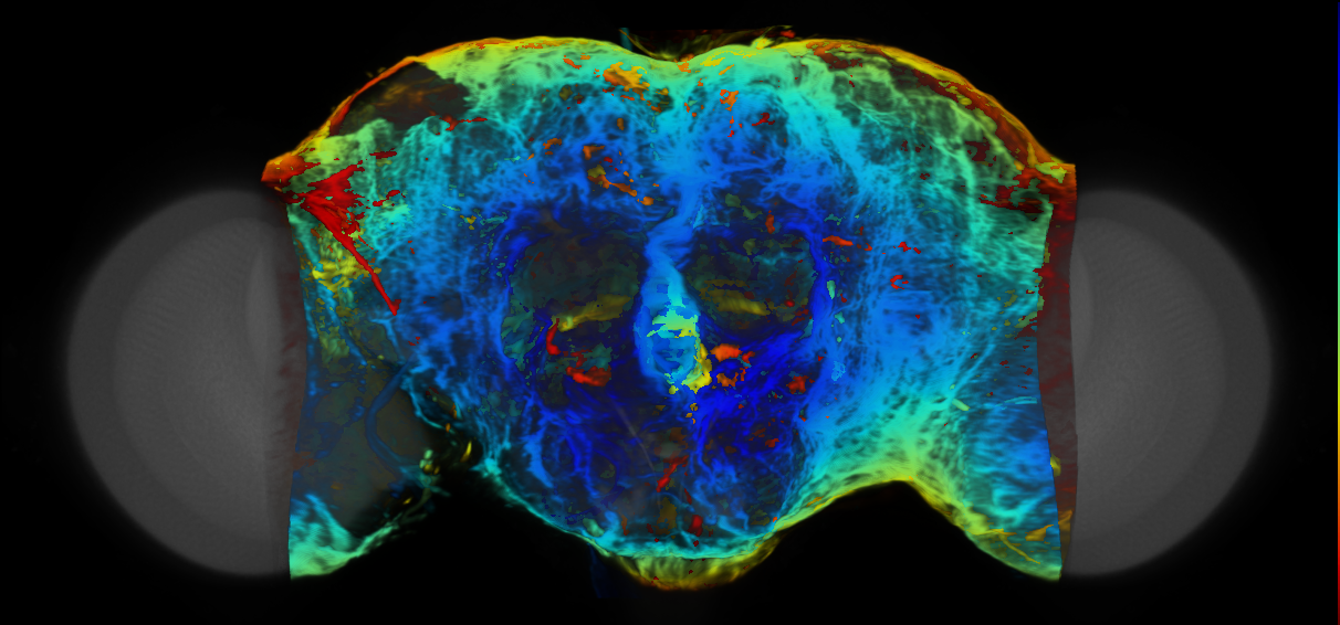 P{VT043544-GAL4} expression pattern