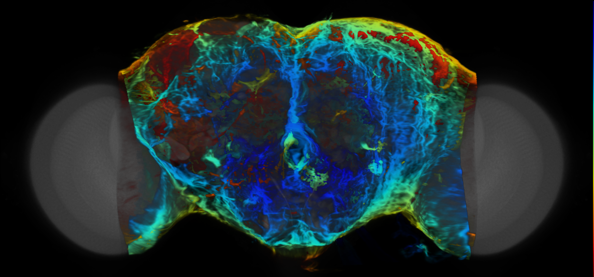 P{VT043544-GAL4} expression pattern
