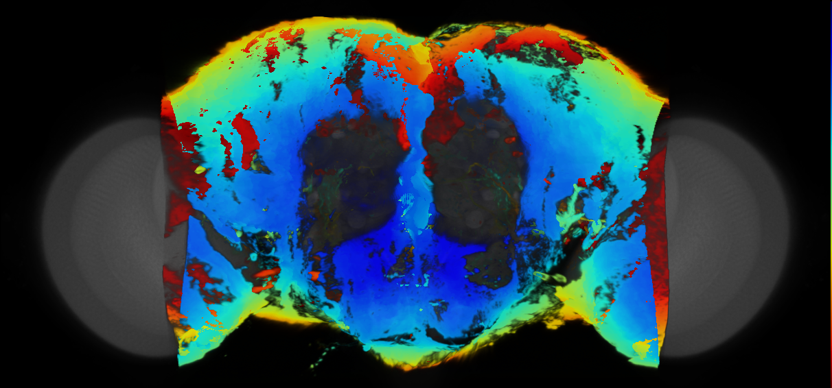 P{VT044324-GAL4} expression pattern