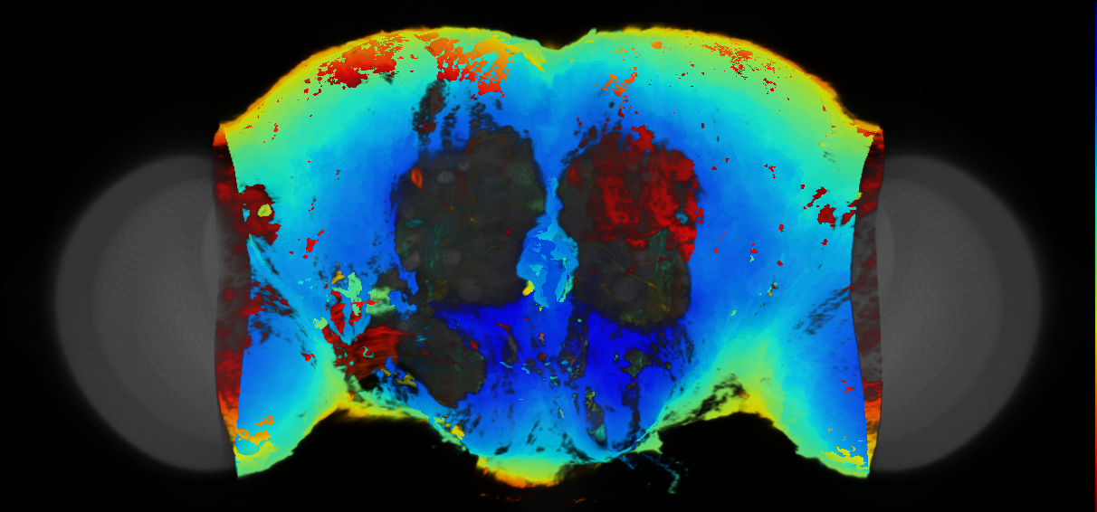 P{VT044324-GAL4} expression pattern