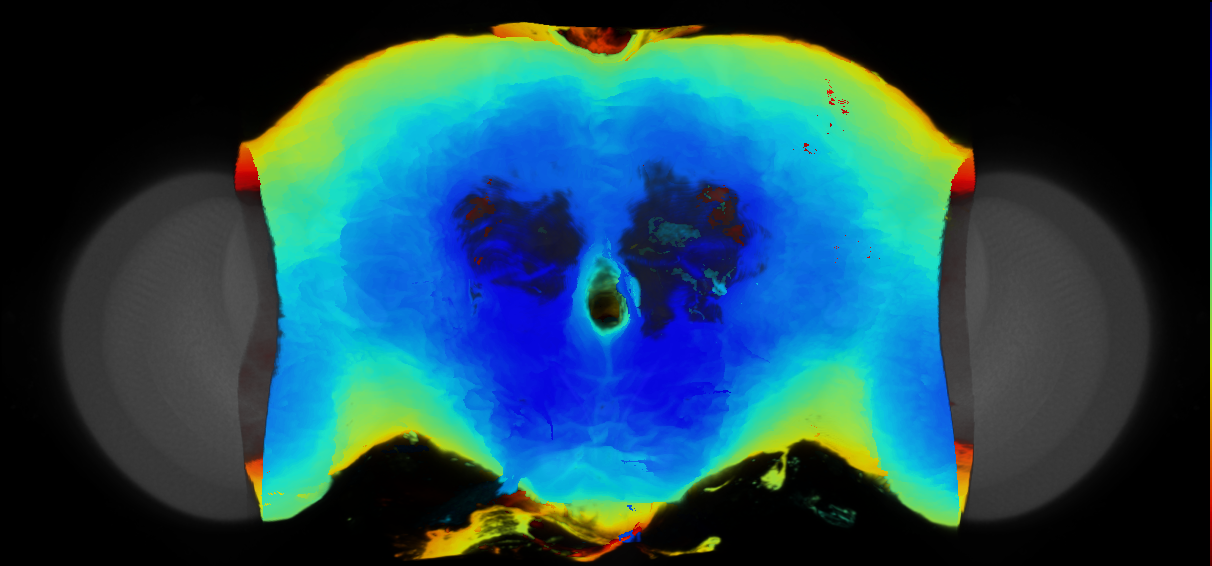 P{VT045611-GAL4} expression pattern