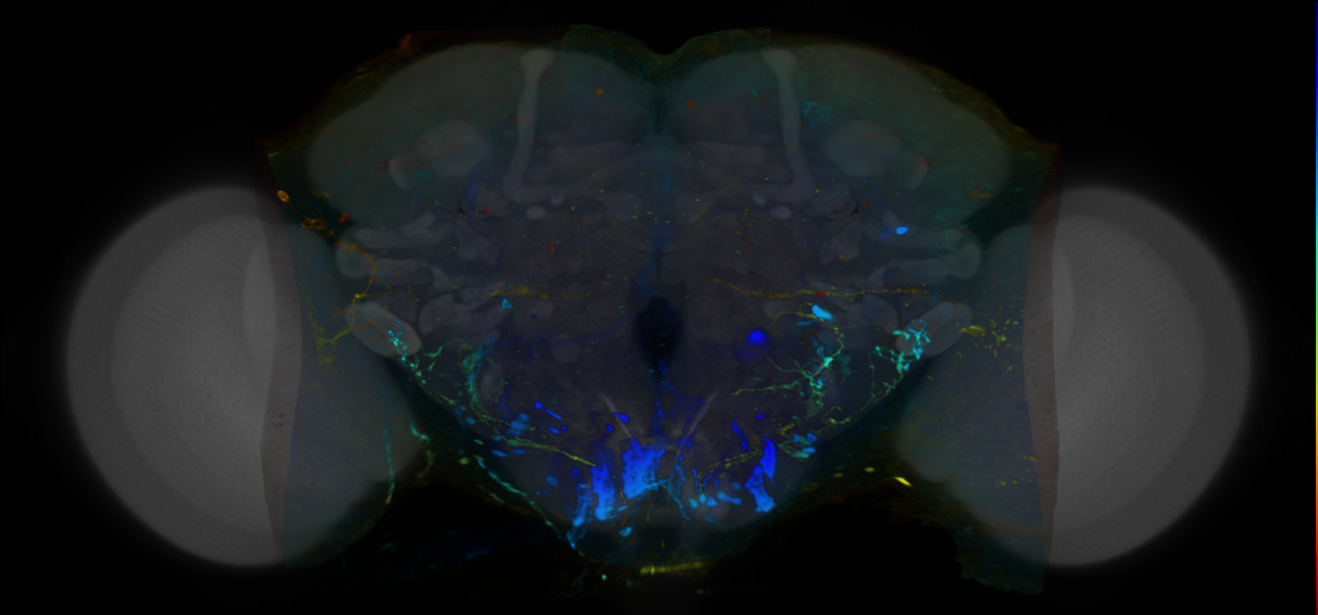 P{VT046907-GAL4} expression pattern