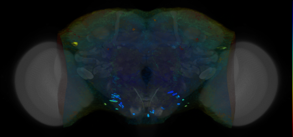 P{VT046946-GAL4} expression pattern
