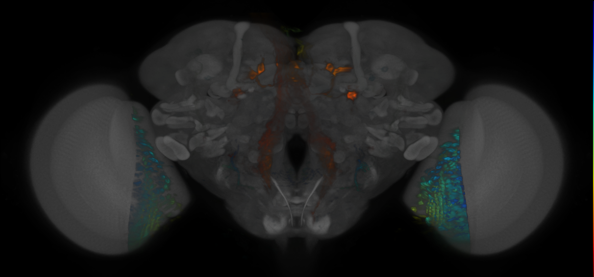 P{VT047170-GAL4} expression pattern