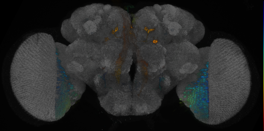 P{VT047170-GAL4} expression pattern