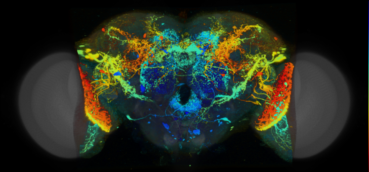 P{VT048874-GAL4} expression pattern