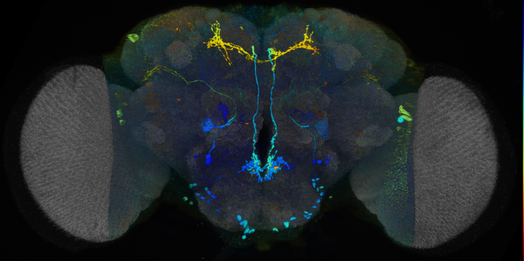 P{VT050157-GAL4} expression pattern