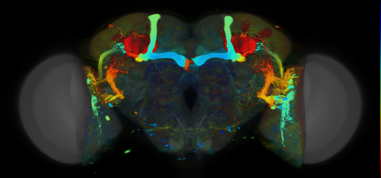 P{VT054844-GAL4} expression pattern