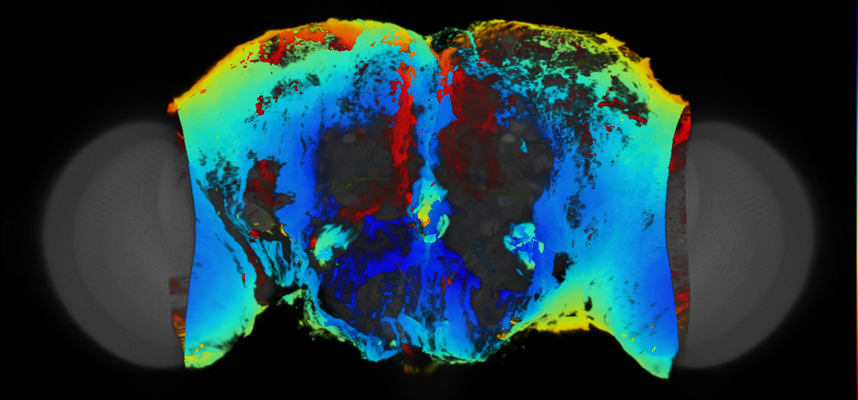 P{VT056445-GAL4} expression pattern