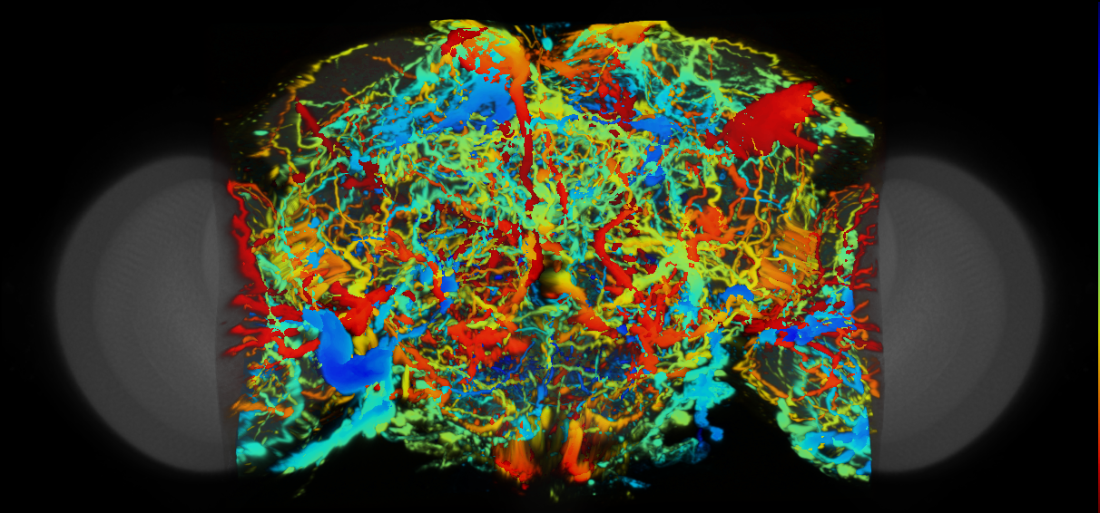 P{VT057086-GAL4} expression pattern
