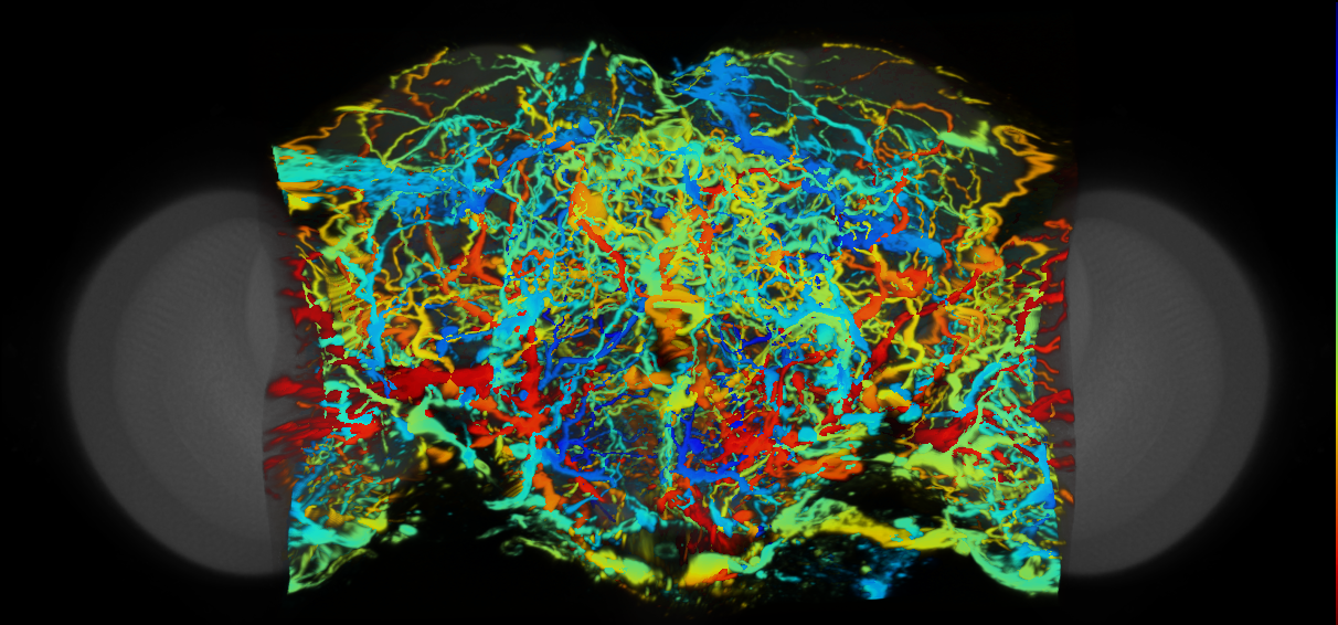P{VT057086-GAL4} expression pattern