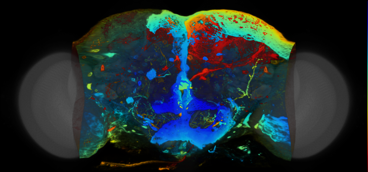 P{VT061460-GAL4} expression pattern