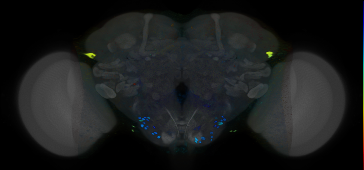 P{VT062093-GAL4} expression pattern