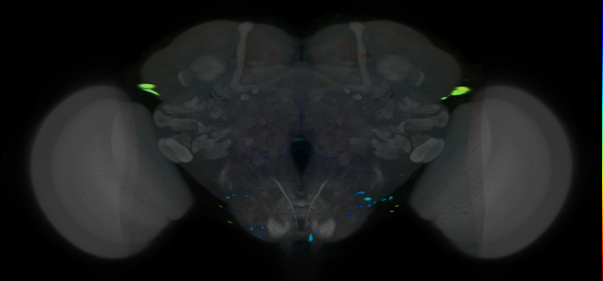 P{VT062093-GAL4} expression pattern