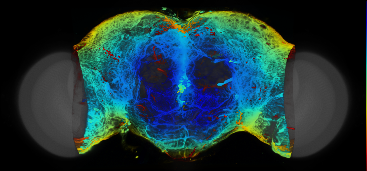 P{VT062445-GAL4} expression pattern