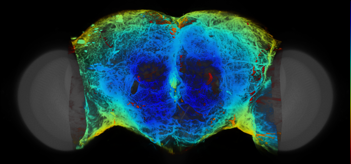 P{VT062445-GAL4} expression pattern