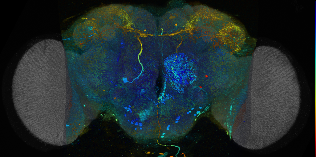P{VT062493-GAL4} expression pattern
