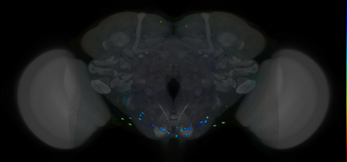 P{VT062863-GAL4} expression pattern