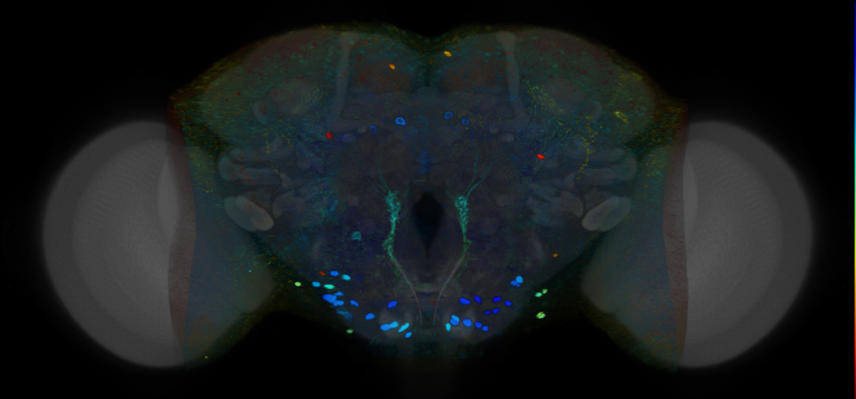 P{VT063176-GAL4} expression pattern
