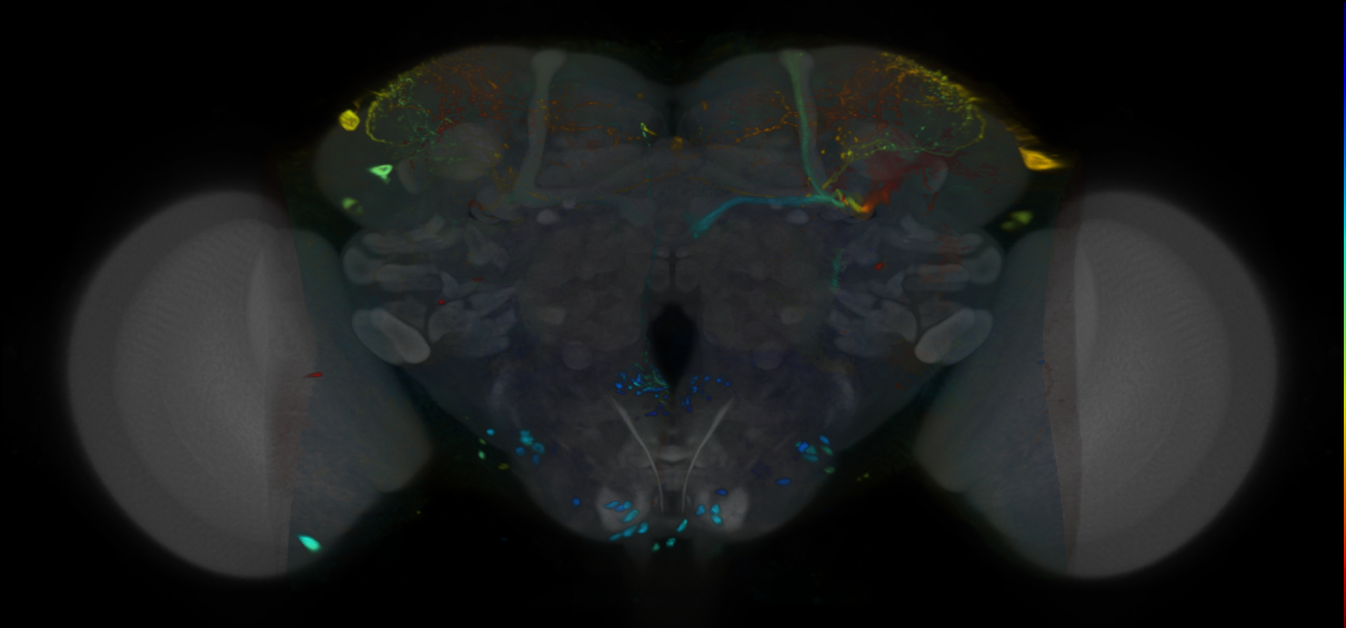 P{VT063534-GAL4} expression pattern