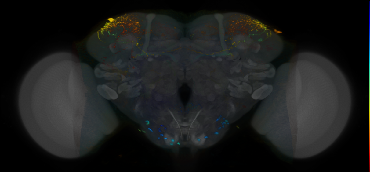 P{VT063534-GAL4} expression pattern