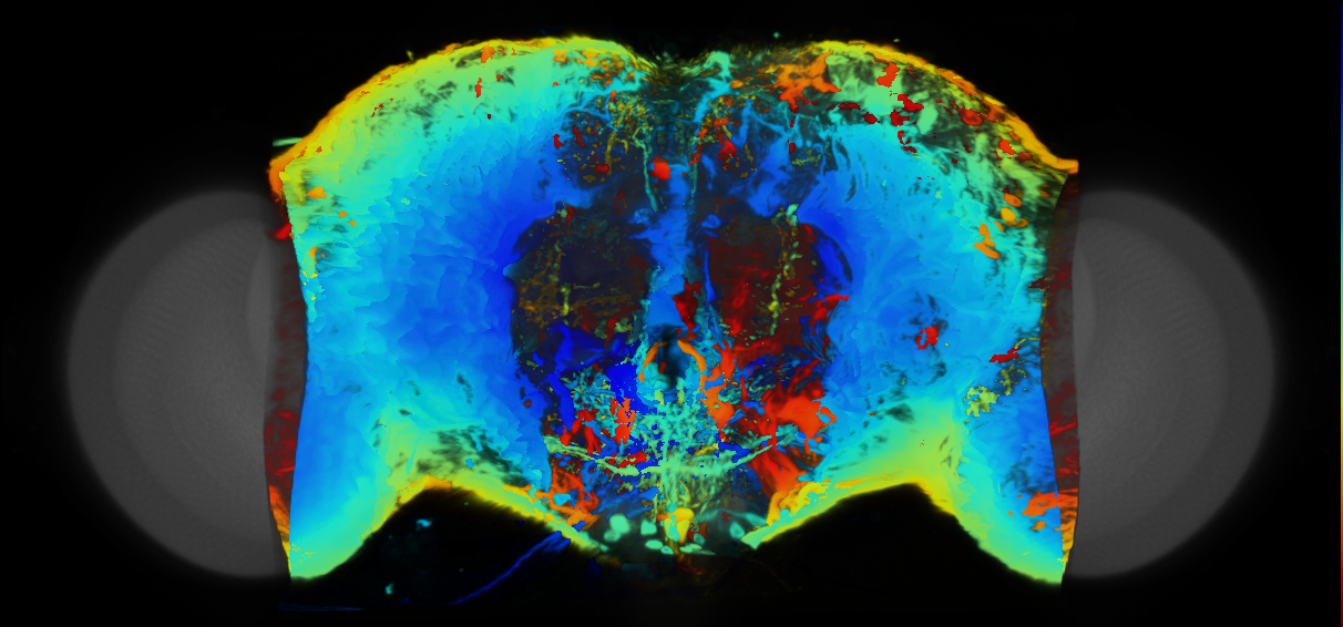 P{VT063623-GAL4} expression pattern