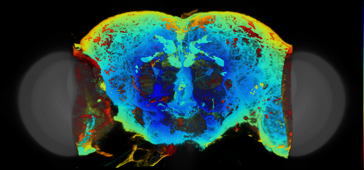 P{VT064888-GAL4} expression pattern