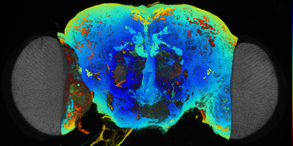 P{VT064888-GAL4} expression pattern