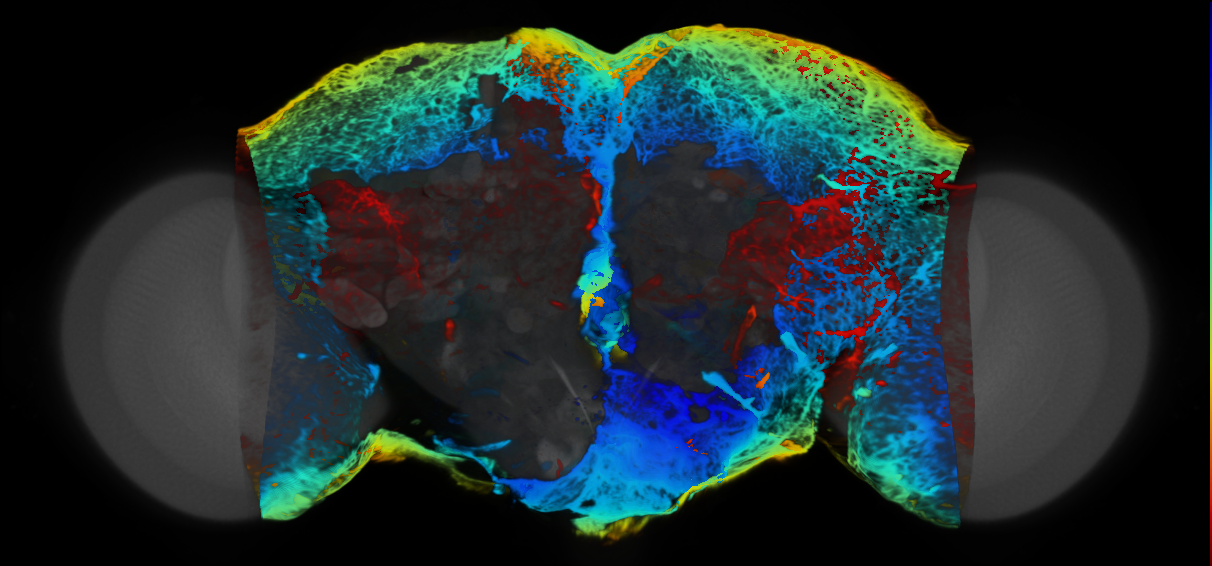 P{VT935224-GAL4} expression pattern
