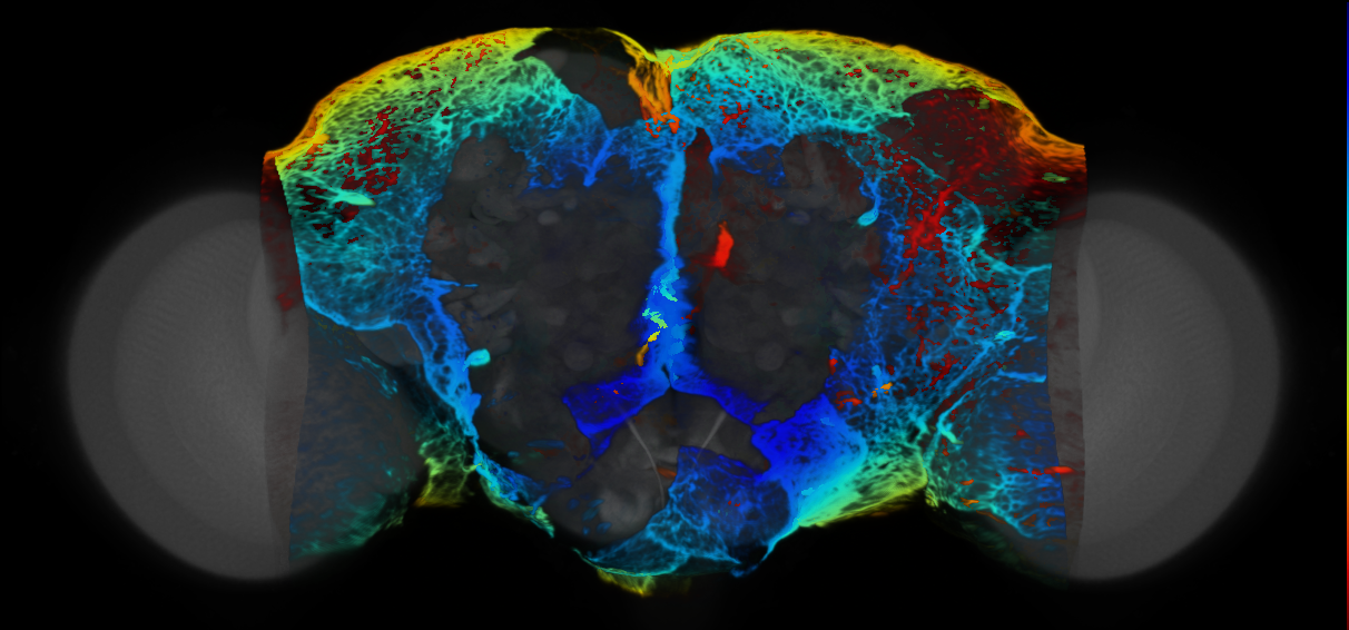 P{VT935224-GAL4} expression pattern