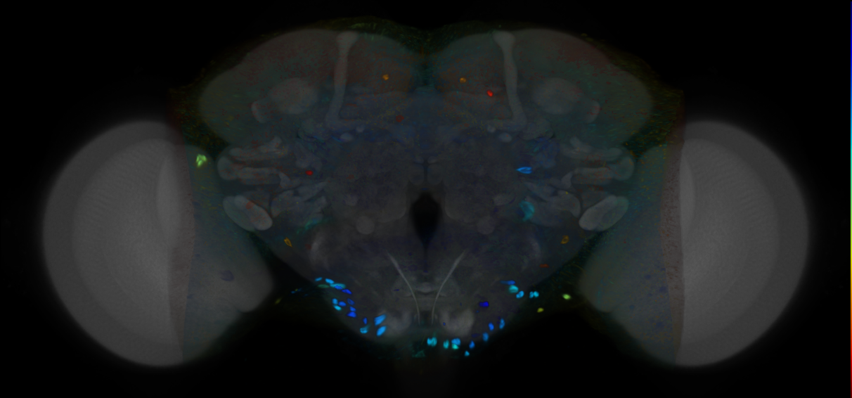 P{VT962911-GAL4} expression pattern