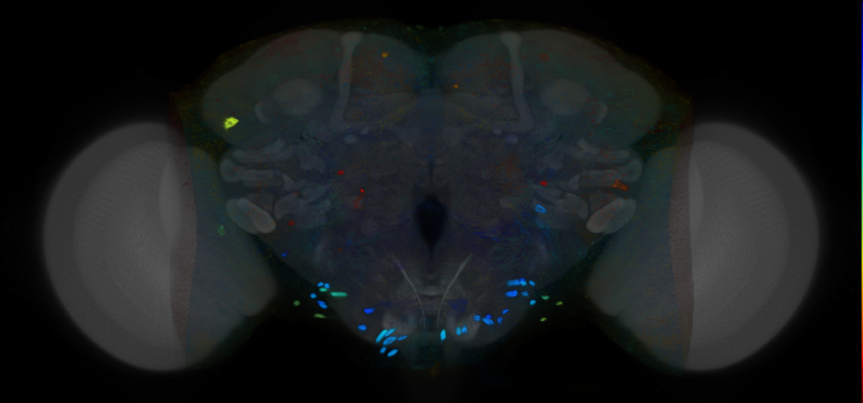 P{VT962911-GAL4} expression pattern