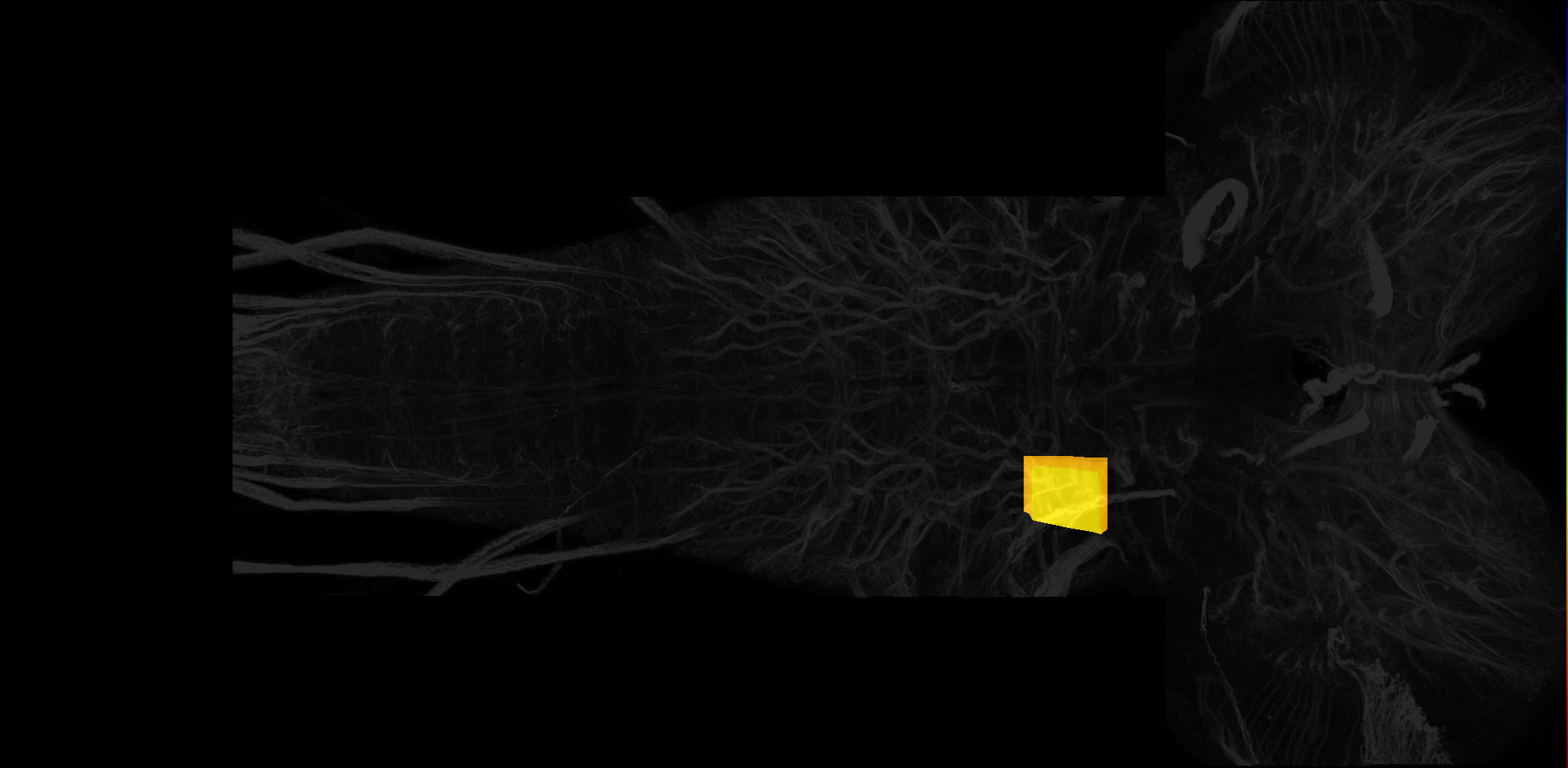 right centrolateral neuropil of T1 on L3 CNS template, Wood2018