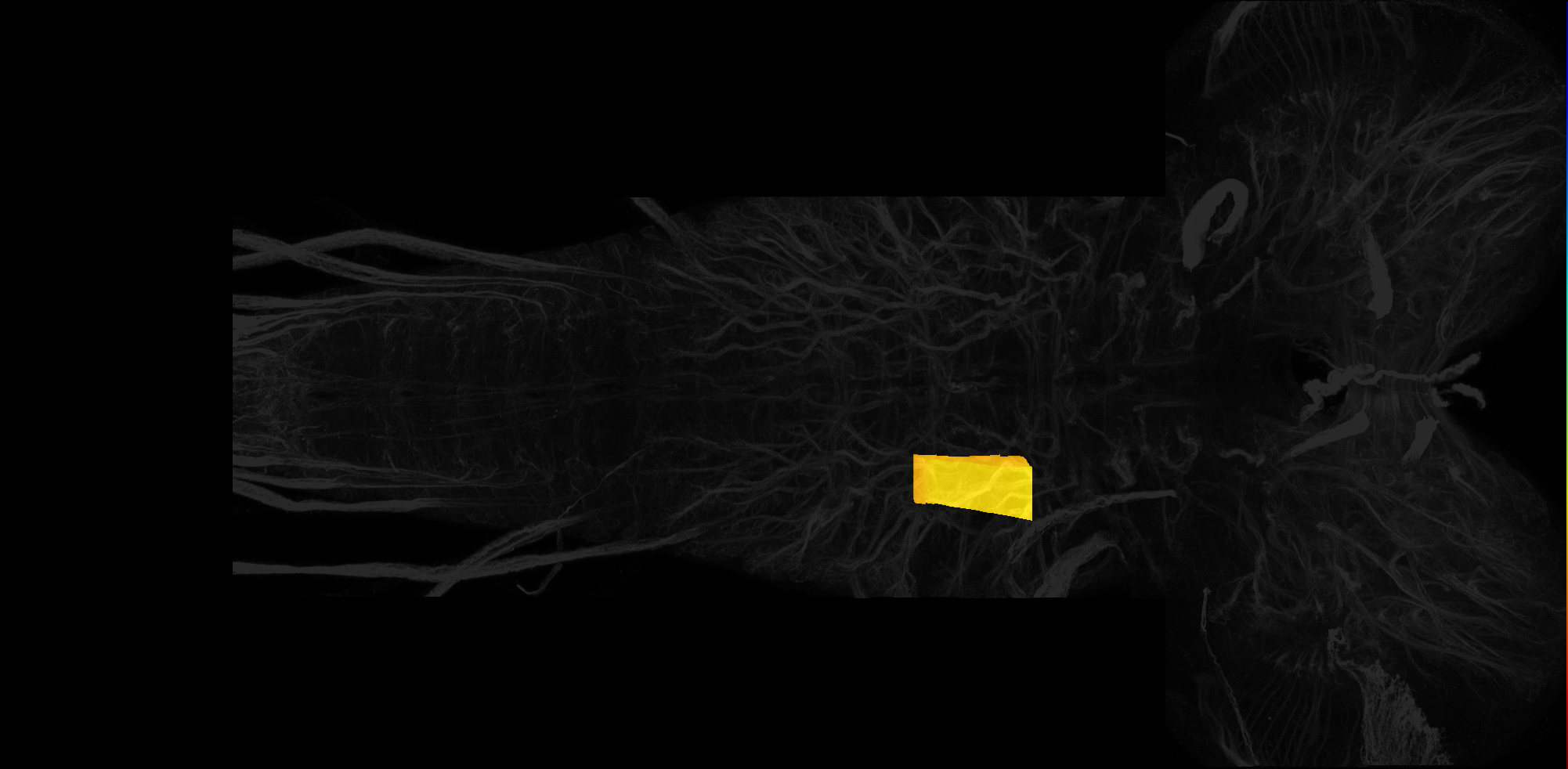right centrolateral neuropil of T2 on L3 CNS template, Wood2018
