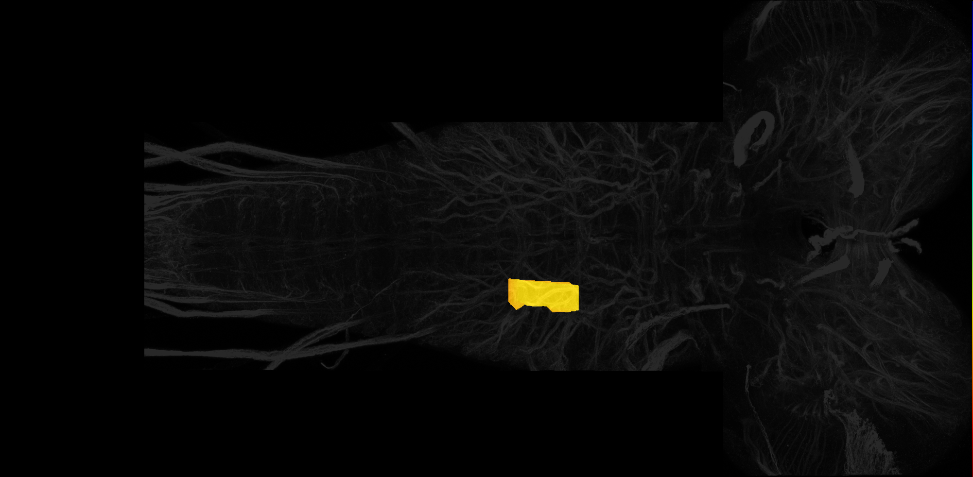 right centrolateral neuropil of T3 on L3 CNS template, Wood2018