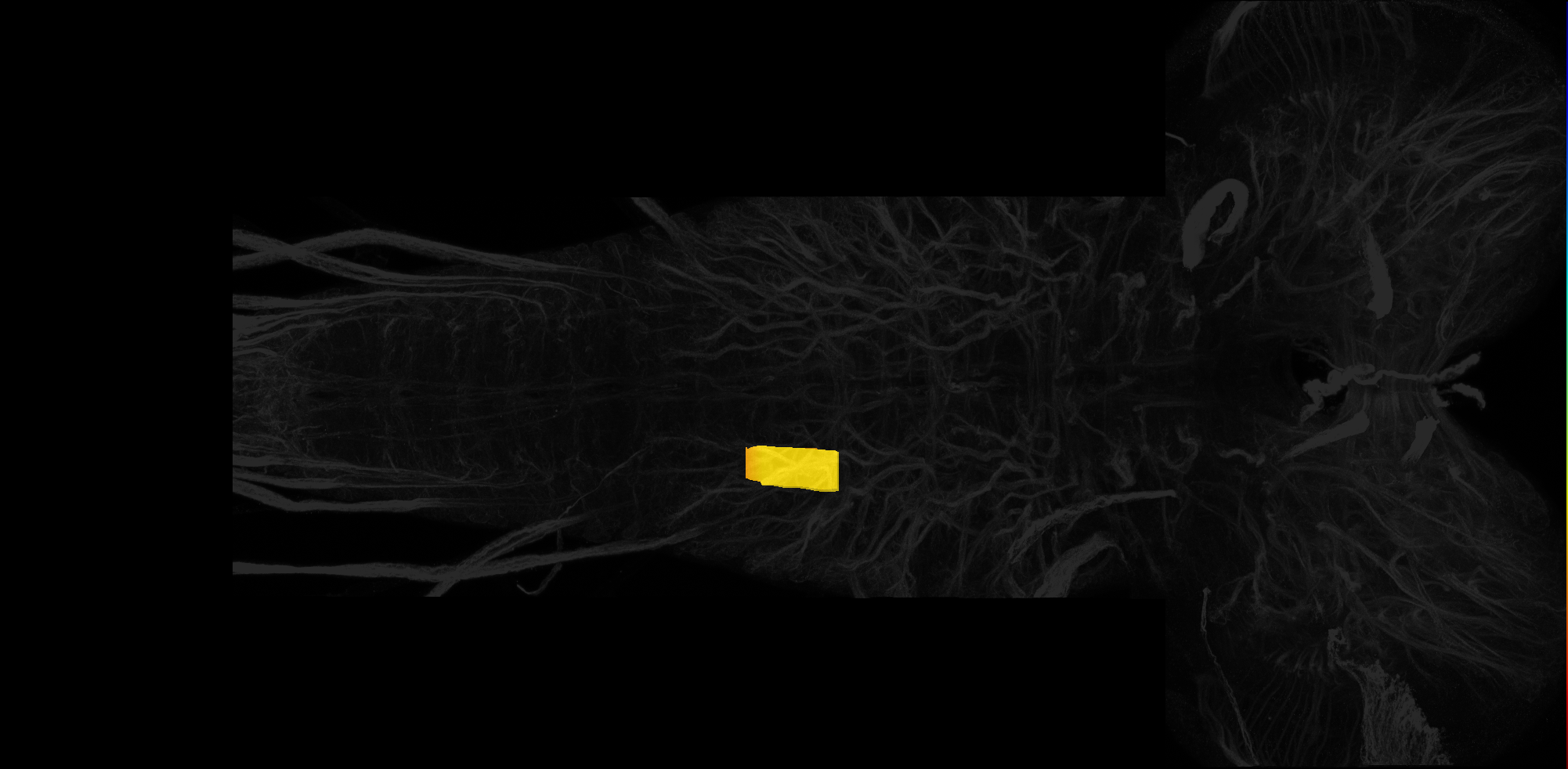 right centrolateral neuropil of A1 on L3 CNS template, Wood2018