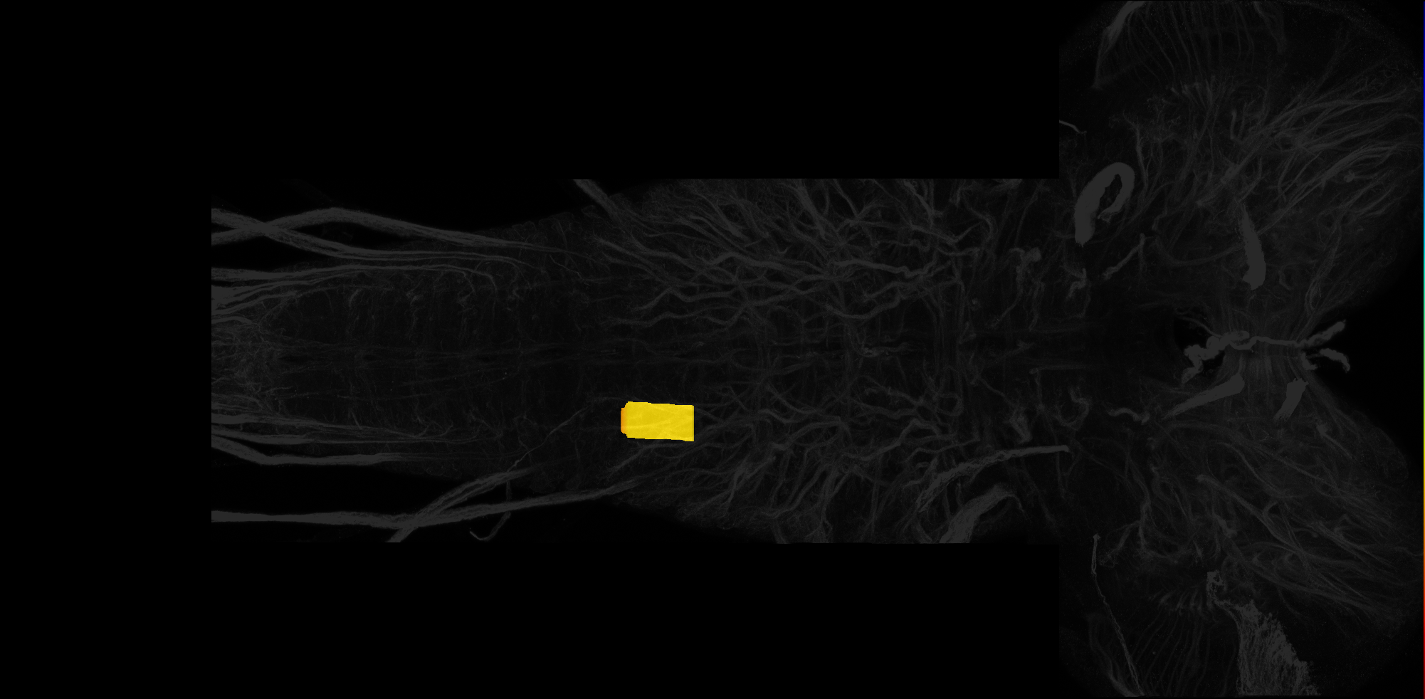 right centrolateral neuropil of A2 on L3 CNS template, Wood2018