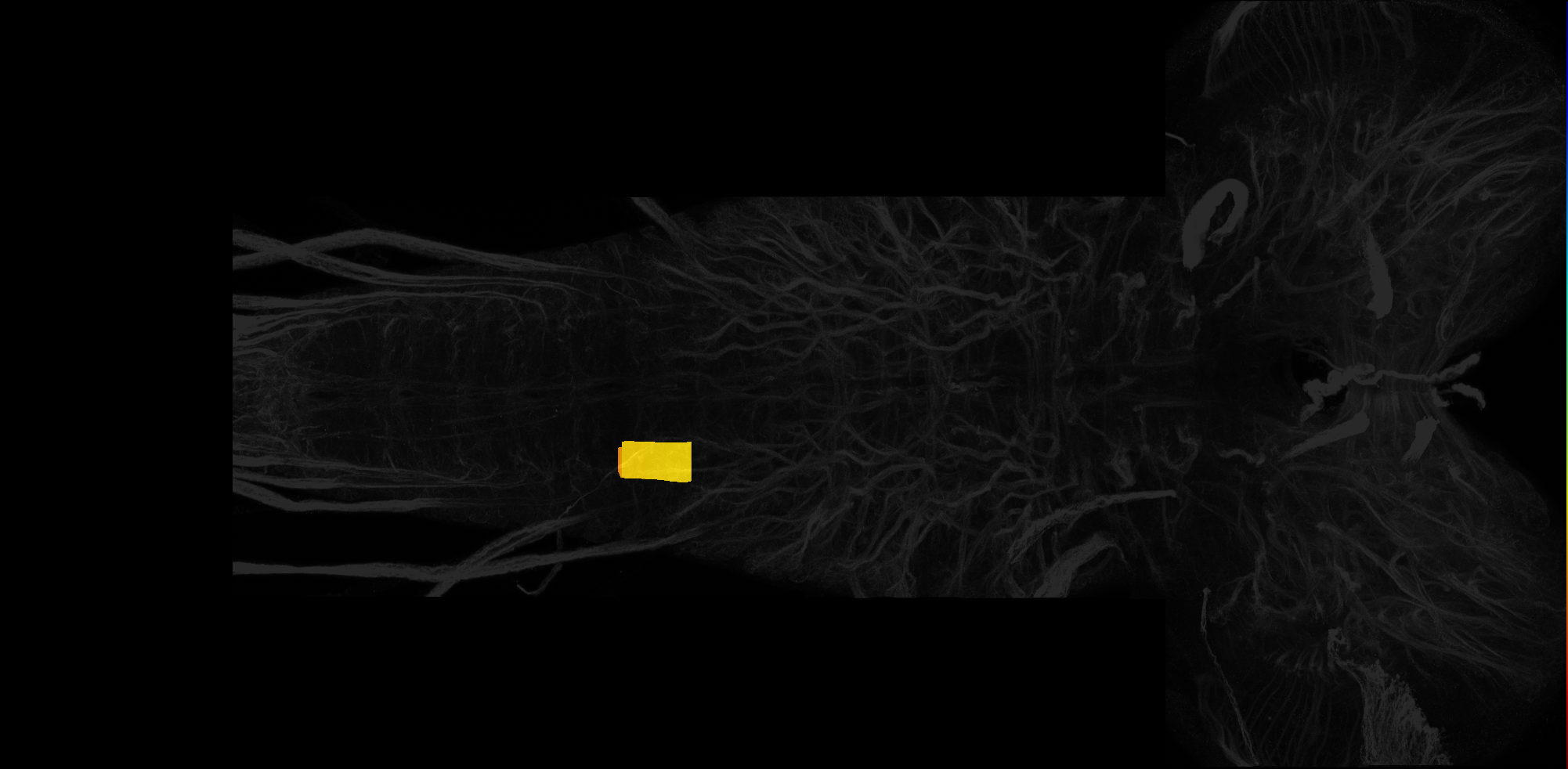 right centrolateral neuropil of A3 on L3 CNS template, Wood2018