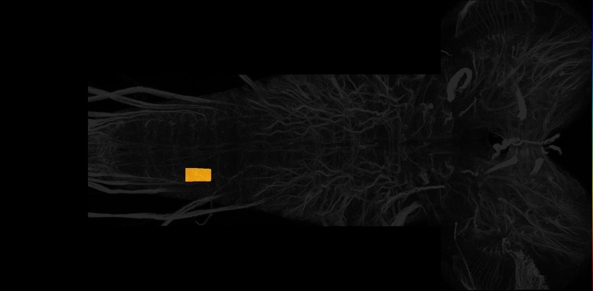 right centrolateral neuropil of A5 on L3 CNS template, Wood2018