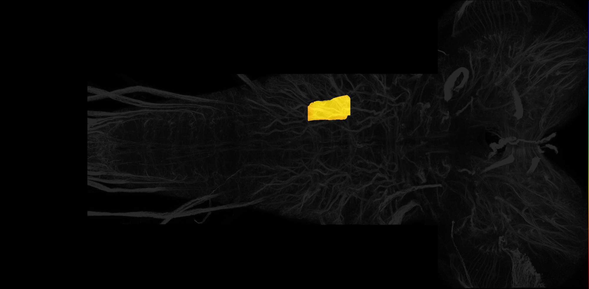 left centrolateral neuropil of T3 on L3 CNS template, Wood2018