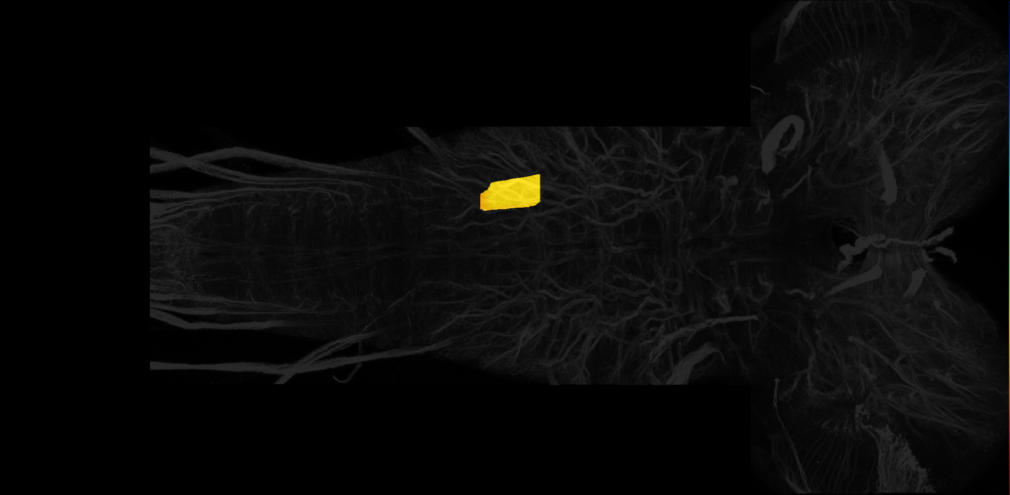 left centrolateral neuropil of A1 on L3 CNS template, Wood2018